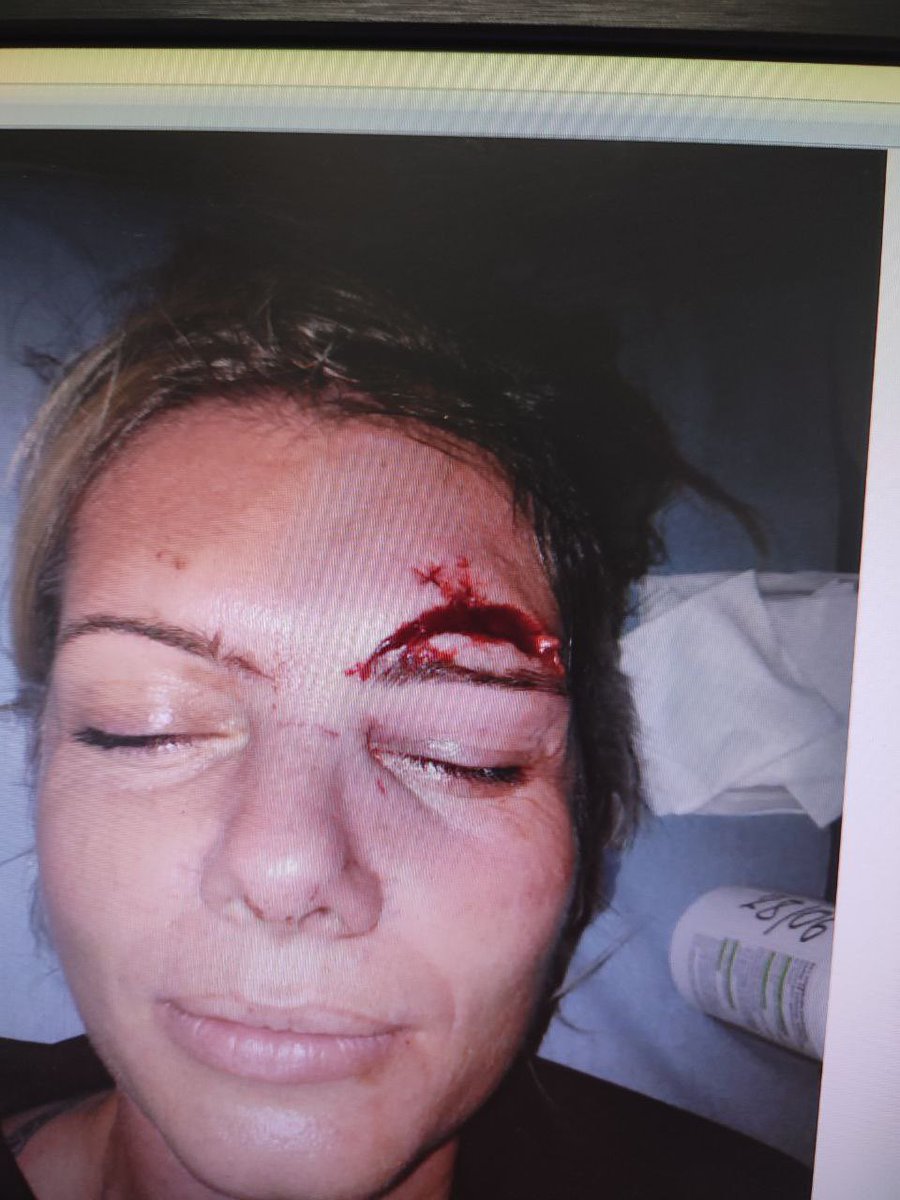 ZemmourEric's tweet photo. Aurélia Maillard, policière à Mayotte, vient de subir la sauvagerie de voyous qui ont osé l'attaquer à coups de pierres. 

Je sais ce que cette femme courageuse fait pour la Reconquête à Mayotte. Courage et merci, chère Aurélia : vous avez tout mon soutien et toute ma reconnaissance.