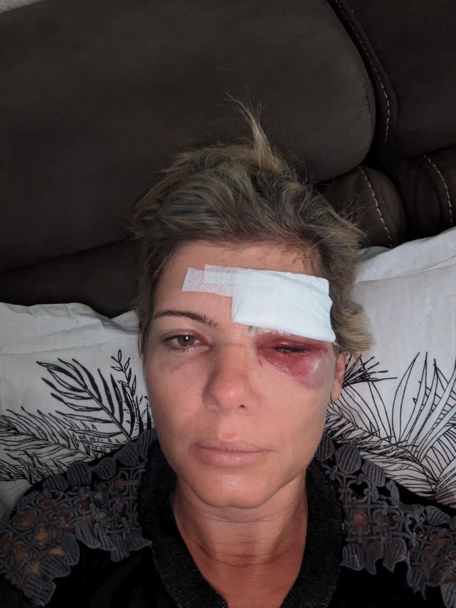 ZemmourEric's tweet photo. Aurélia Maillard, policière à Mayotte, vient de subir la sauvagerie de voyous qui ont osé l'attaquer à coups de pierres. 

Je sais ce que cette femme courageuse fait pour la Reconquête à Mayotte. Courage et merci, chère Aurélia : vous avez tout mon soutien et toute ma reconnaissance.