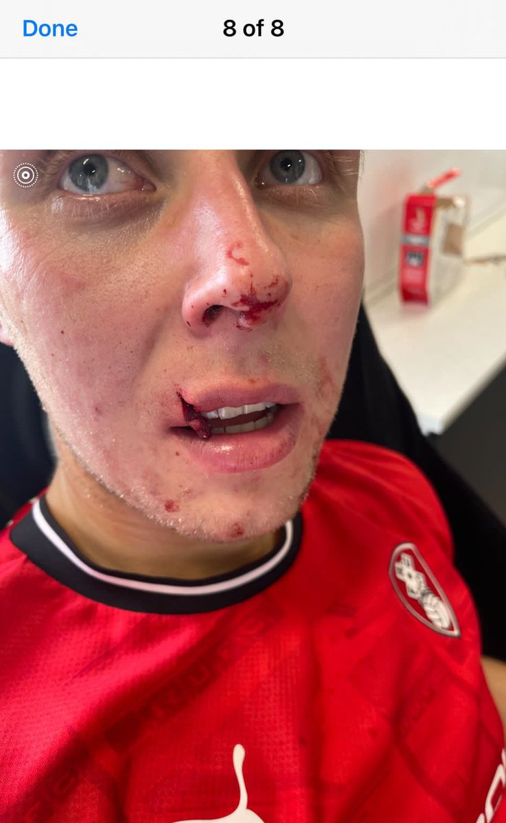 The_RUFC's tweet photo. Keep your wits about you tonight everyone, my son just got jumped by a Parkgate firm. They call themselves ‘Men of Steel’ but pick on an innocent teenager 🤬 He’s ok albeit a little shaken up. We all knew there’d be trouble tonight - why did SYP let it go ahead?! 😡 
#RUFC https://t.co/H5DiWF5M7x