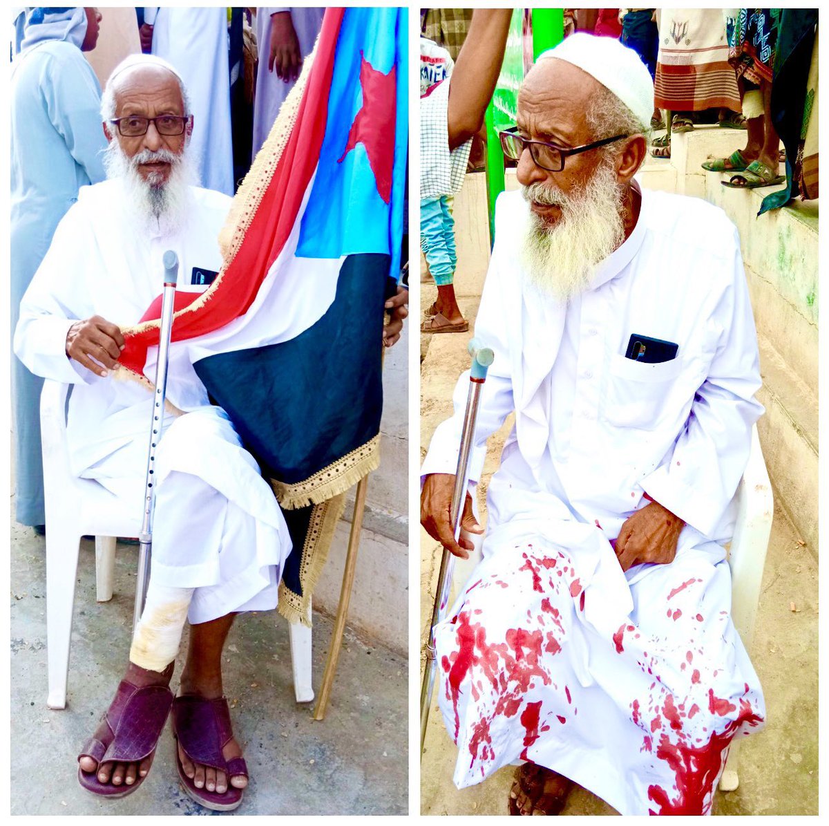 قلنا في التغريدة السابقة دم كذبي ولو كان حقيقي قولوا لنا من فين طلع
قالوا من رجله وراحوا عملوا لفة للرجل ونيسوا يحطون الفيمتو على  الثوب من جديد