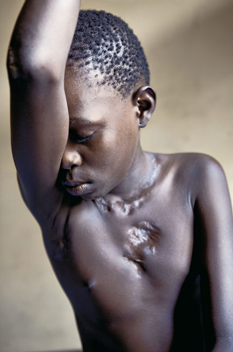 Élysée tiene 12 años y vive en un centro para niños de la calle. 
Cuando su madre murió, fue entregada a su tía, que la acusó de brujería para librarse de ella.
 La llevó a una iglesia donde, a modo de exorcismo, fue torturada con una plancha..
Los torturan, los echan de casa e