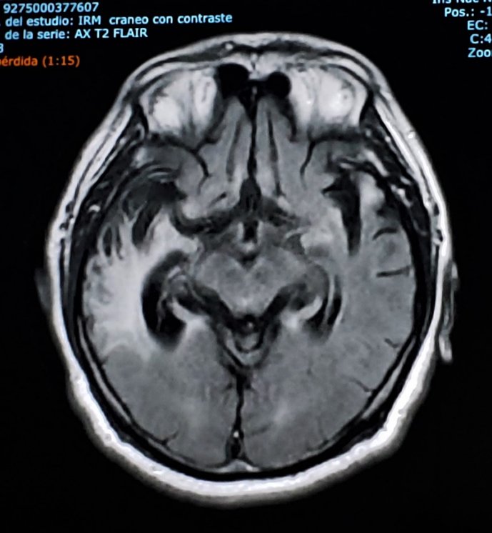 Jesus Ramirez-Bermudez tweet media