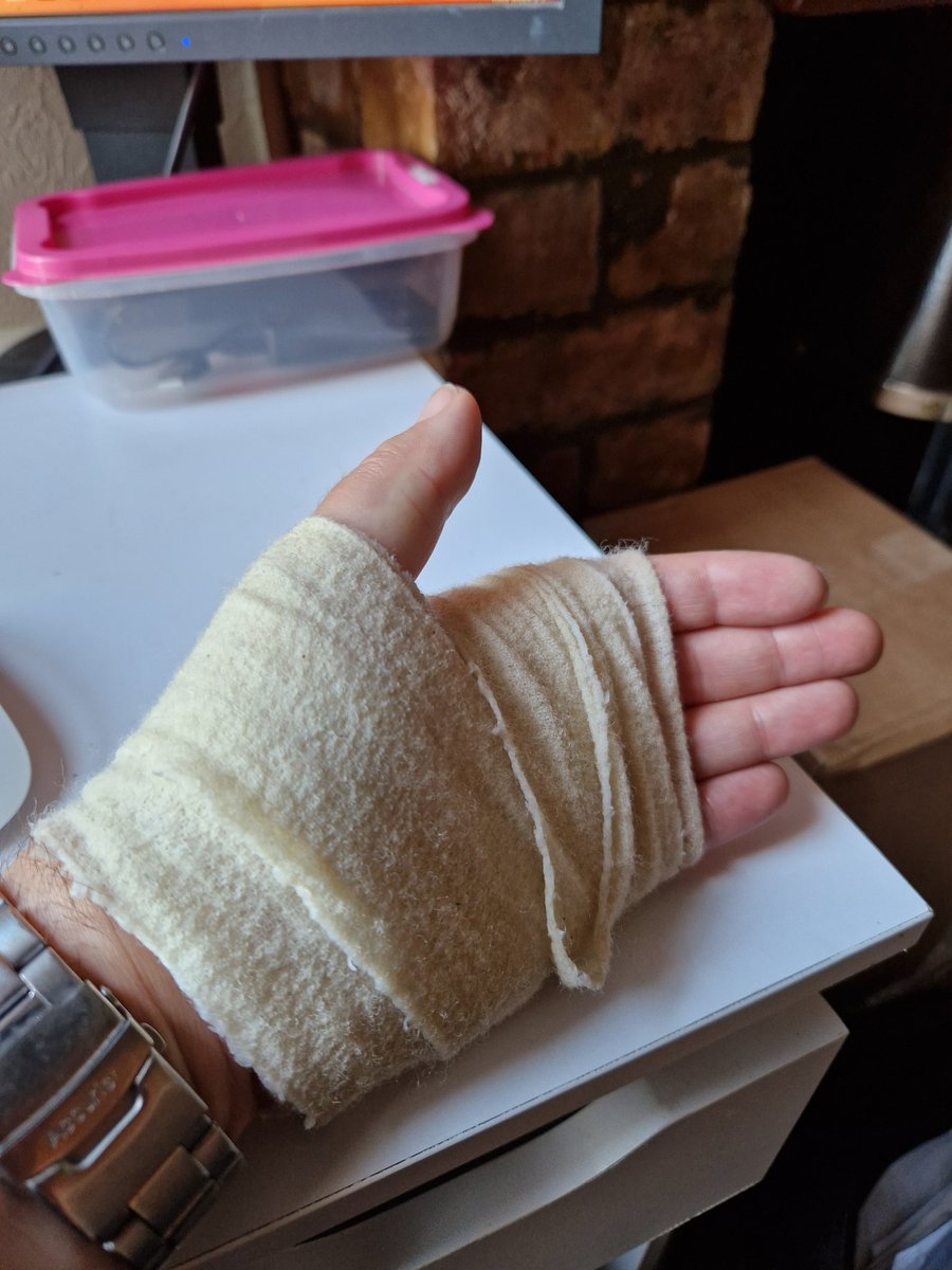 David_Simister's tweet image. And the winner of today's needlessly sustained injury is...me. Don't leave cans of drink in cars on hot days, kids...