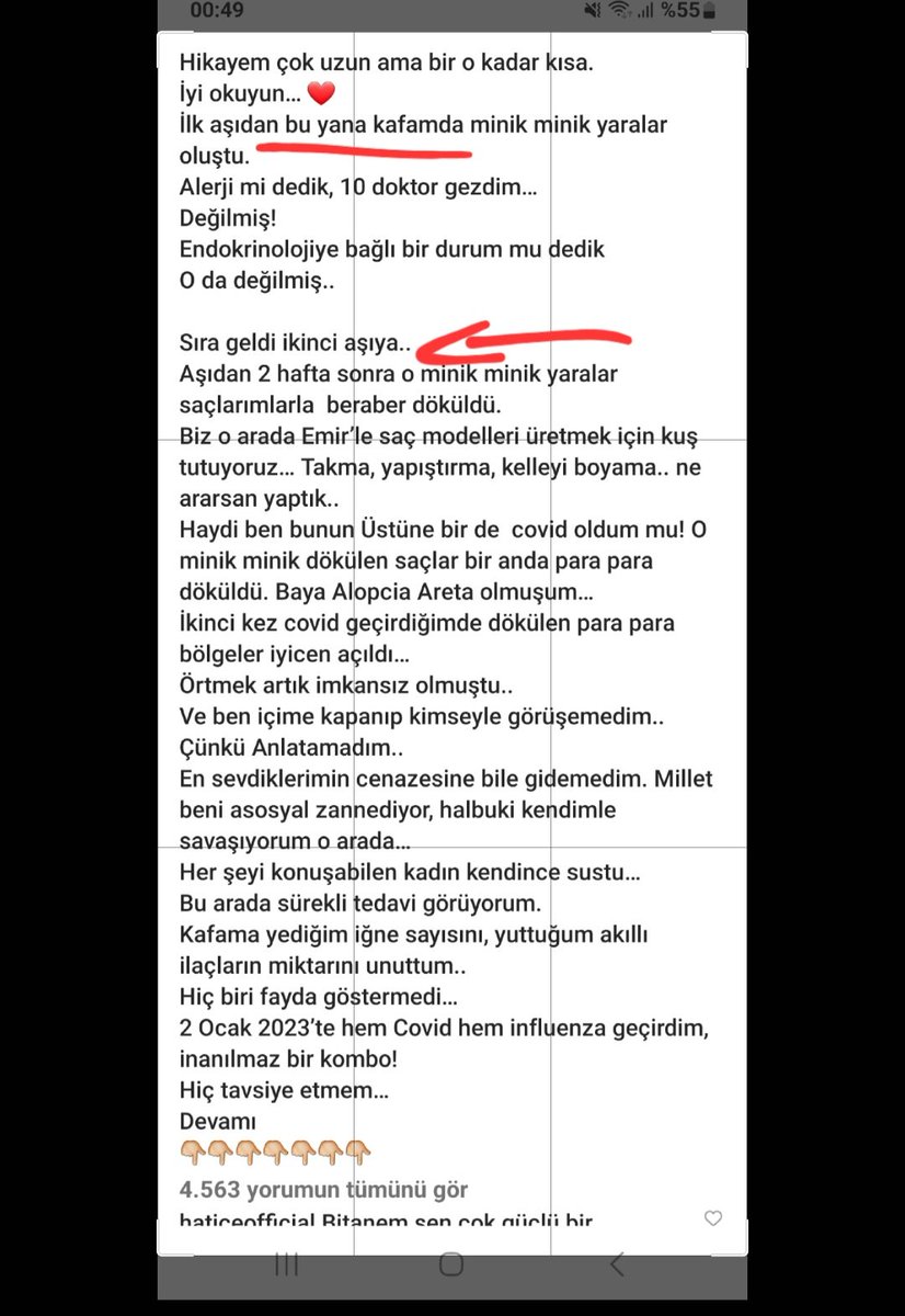 SerkanK16508934's tweet photo. Ünlü sanatçı ışın karaca Covid aşı'sından sonra sağlığını kaybettiğini söylüyor, https://t.co/FMRvHoAp2M