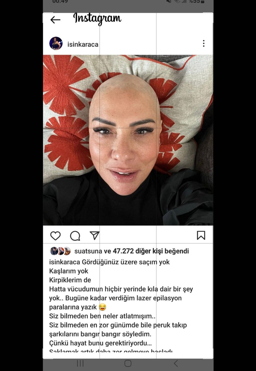 SerkanK16508934's tweet photo. Ünlü sanatçı ışın karaca Covid aşı'sından sonra sağlığını kaybettiğini söylüyor, https://t.co/FMRvHoAp2M