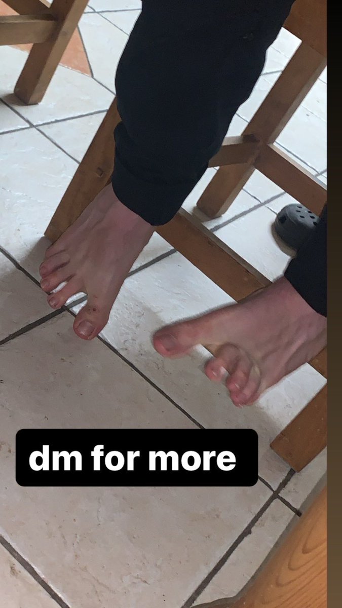 YorhaUnit420's tweet photo. these are my beautiful feet https://t.co/cv797Q3rbj
