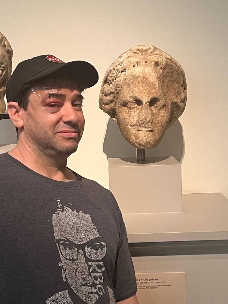 "Hanging out with statues of broken faces to feel better about my broken face." (at <a href="/metmuseum/">The Metropolitan Museum of Art</a>)