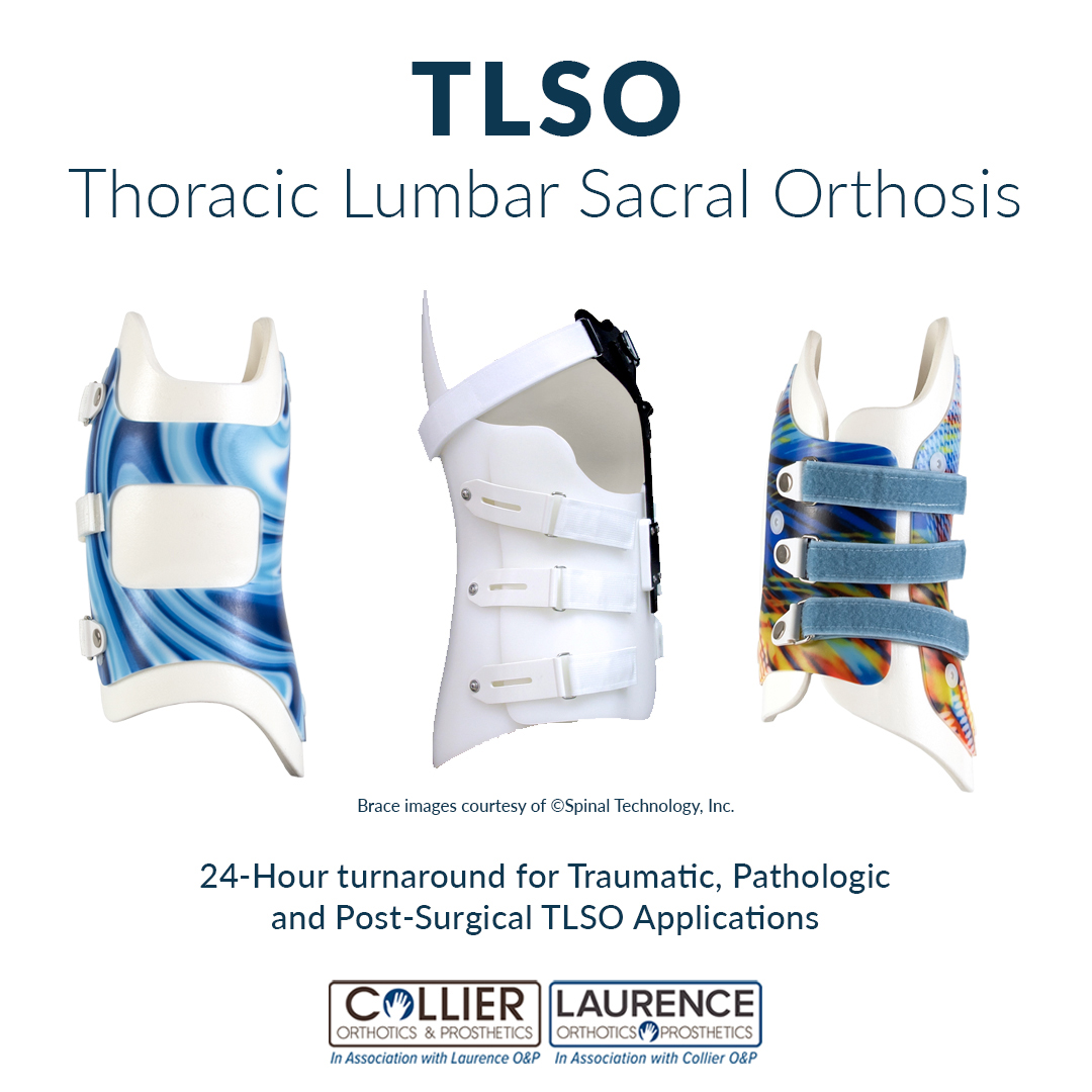 CollierOandP's tweet photo. For traumatic and pathologic fractures, the #TLSObrace is used to stabilize the spine. Some #congenital conditions also require patients to wear a #TLSO to help them maintain a sitting position. #spinalbrace https://t.co/dZVxMe1fYt https://t.co/H7Ng2BWU3e