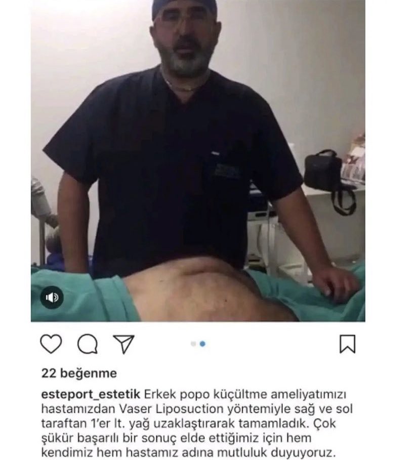 ufak bi operasyon geçerdim şu an iyiyim🙏🏻