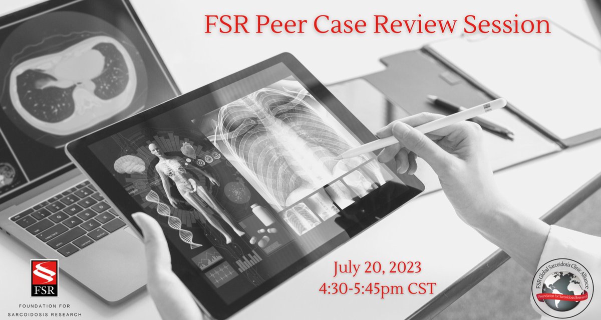 StopSarcoidosis's tweet photo. For clinicians only: Join FSR on on 7/20 for a new FSR-GSCA’s Peer Case Review Session. Two unique cases will be presented! This event is virtual and complimentary. Learn more &amp; register: https://t.co/mcxs9qdEFU

#sarcoidosis #sarctwitter https://t.co/FCK2JDGaqn