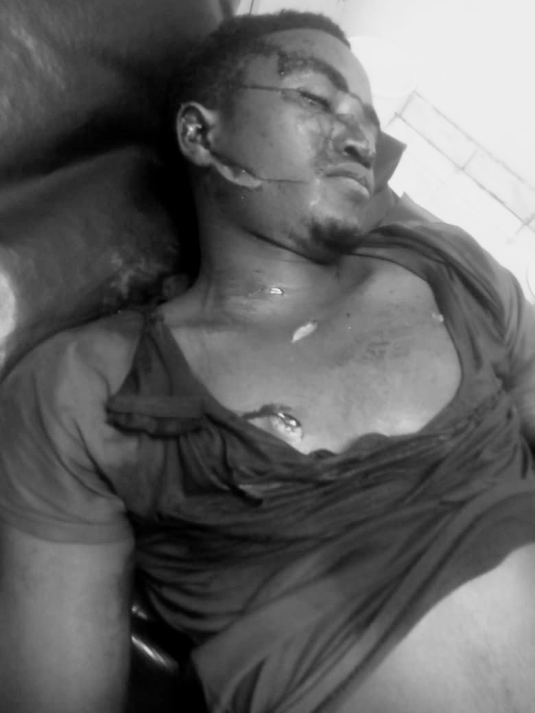 RAYDREW254's tweet photo. Another bad day in kakuma refugee camp we've lose another LGBTQ+
REST IN PIECE . https://t.co/sp55gN2ZjI