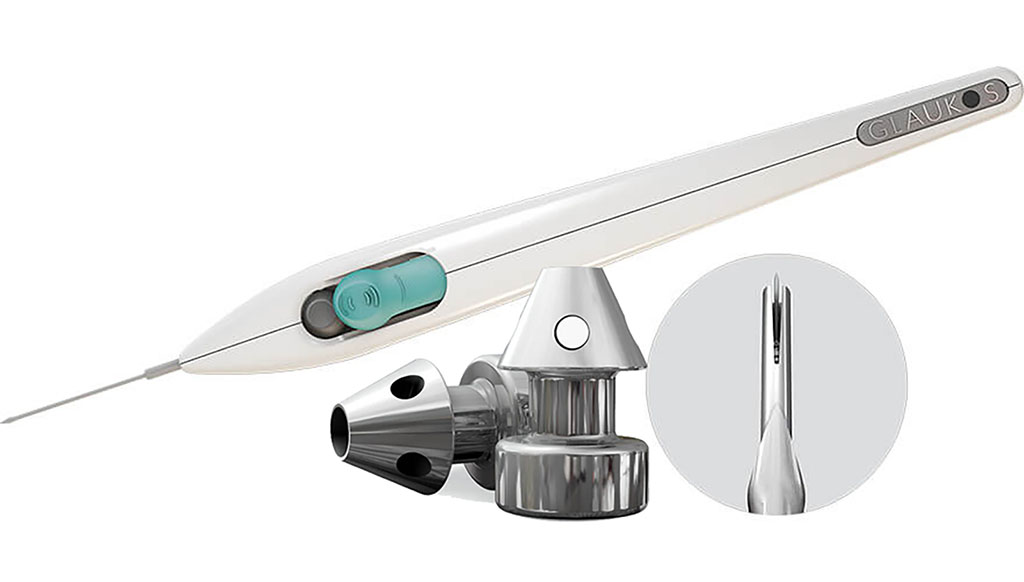AUTM's tweet photo. Check out this #BetterWorldProject story from @UCIrvine! Discover how iStent—the world's tiniest medical device—has helped 68% of #glaucoma patients stay medication-free a year after surgery! Read more: https://t.co/FVb5ZTYnye https://t.co/zLfzPnr9i9
