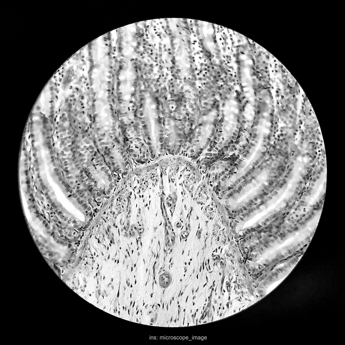 bd7pa's tweet photo. Clean the light path of the microscope. #microscope #microscopeimage https://t.co/H7Buidw2E6