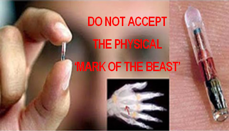 LightInTheDarkP's tweet photo. DO NOT ACCEPT RFID microchip implants! 🛜 🫱 

Read Revelation 13:16-19 about the New World Order currency system

🔗 https://t.co/JCFGshtIm2 https://t.co/kIcKisgGrq
