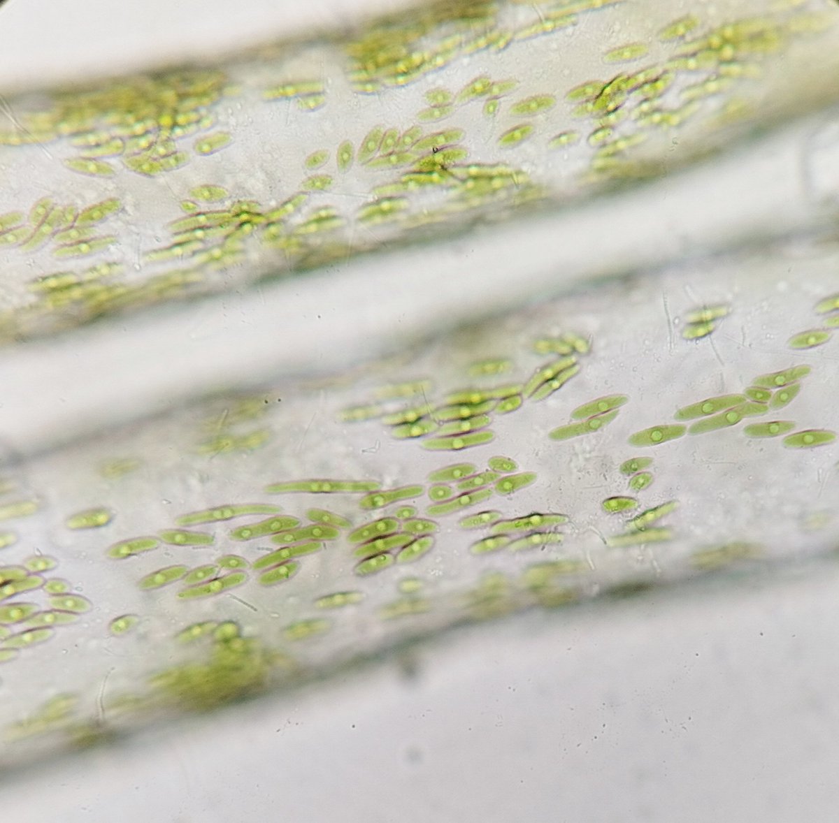 viwanaiguana's tweet photo. Cloroplastos de Bryopsis 
#PhycoFriday
#ChileSeaweeds https://t.co/K5jwuOocRK