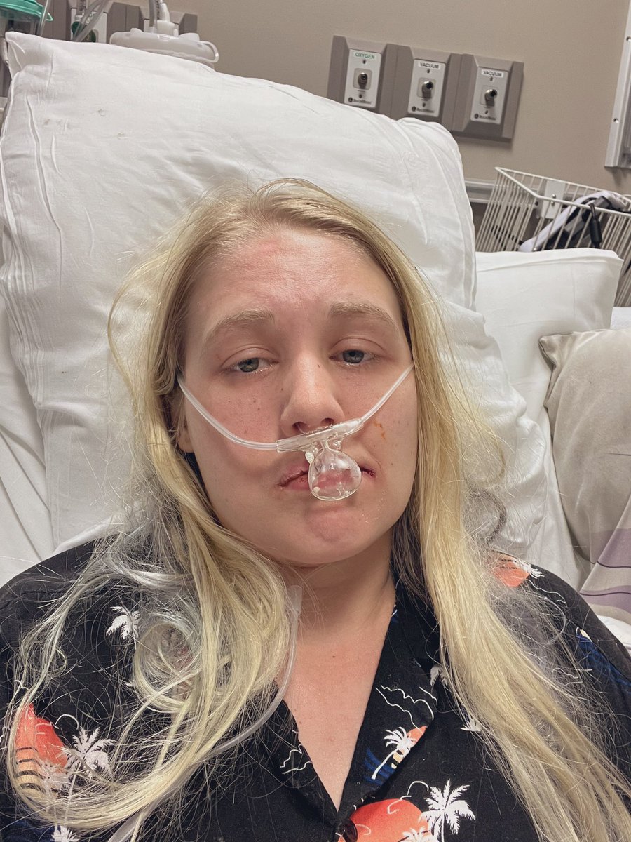 AlphaSuri's tweet photo. Awroo! Greetings wolves, I missed you all. I’ve been hospitalized this whole month of June till now. Trying to stop my lungs from bleeding out. Many surgeries. But I’m home now with IVs and trying to get back to YouTube. Thank you all for supporting me. Coming back strong! https://t.co/txdzR9cCYX
