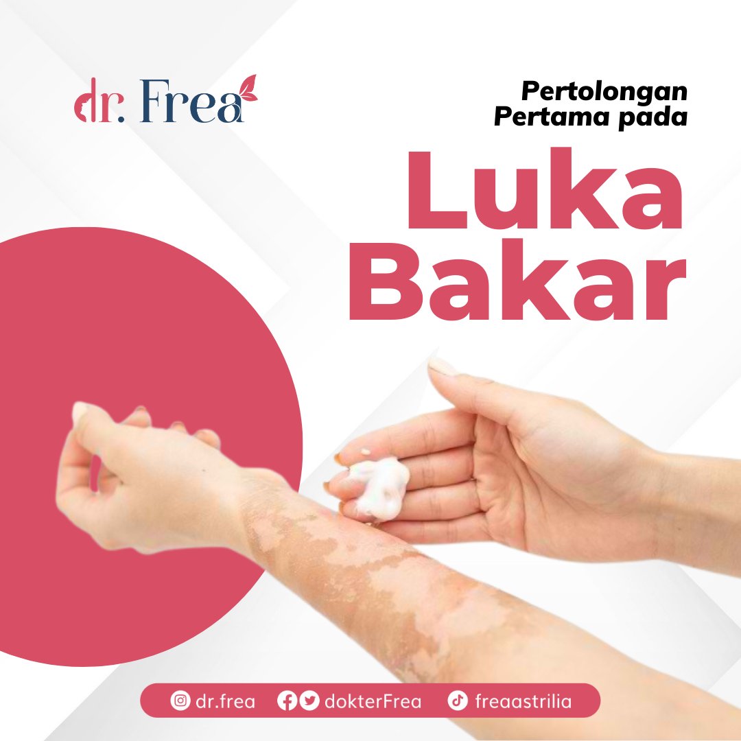 dokterFrea's tweet photo. Pernah gak sih kalian terkena luka bakar?
Nah, pada tahu gak nih gimana cara menanganinya? Yuk simak penjelasannya di postingan ini!

#lukabakar #pertolonganpertamalukabakar https://t.co/gtLwyBKcGF
