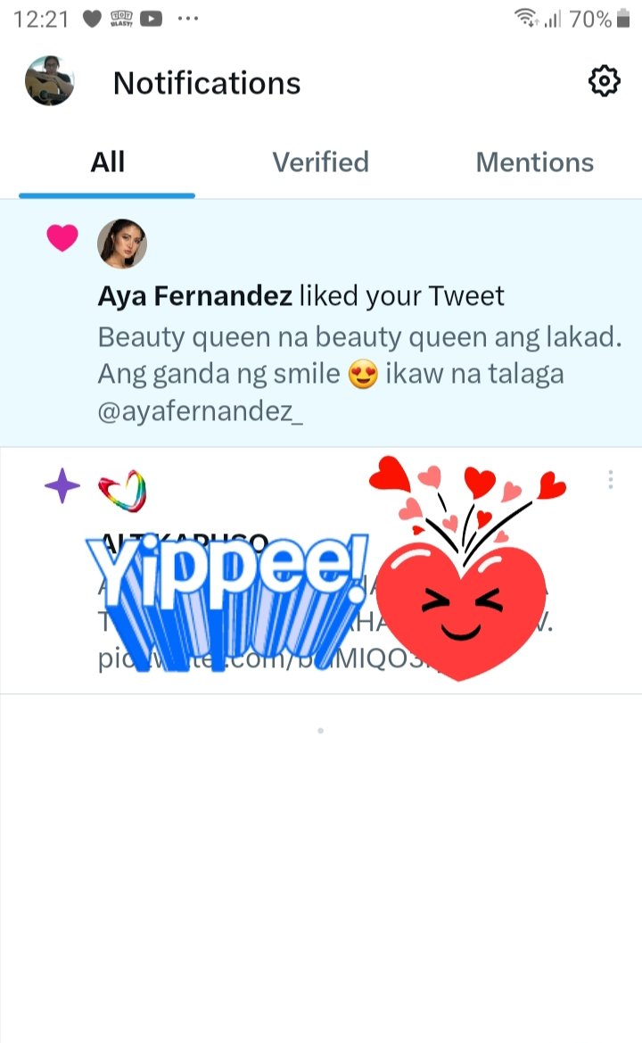 MarieAslor's tweet photo. Yes! Napansin na din ni @ayafernandez_ ang tweet ko . So ano ang kasunod nito? Insomnia? 
#happylungs #kabilangsidengmundo https://t.co/sslGrrouox