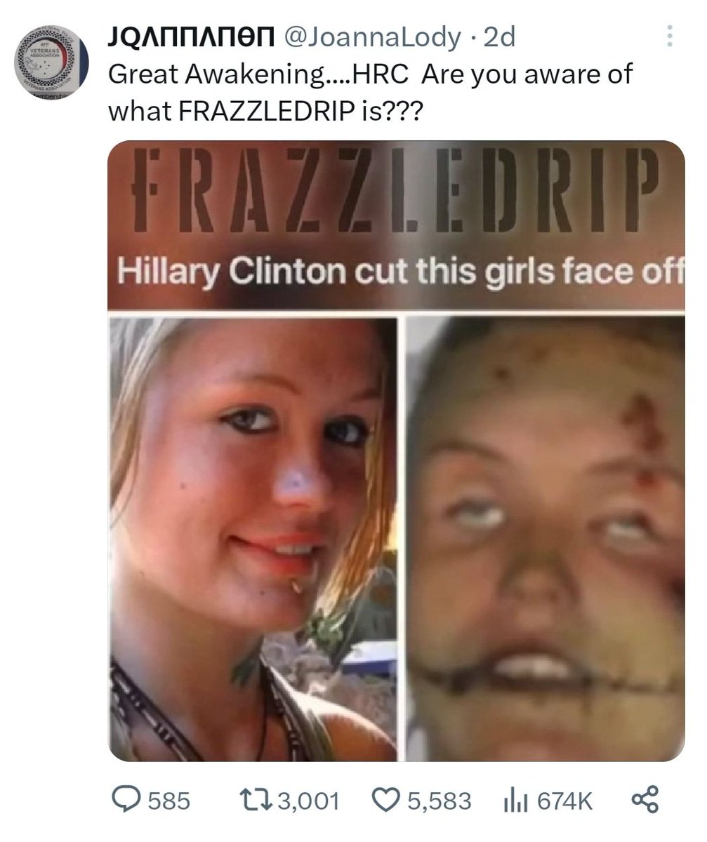 51YWNBAW51's tweet photo. Curtis👁️Blackburn #killer7 Coburn Elementary #FRAZZLEDRIP #YamatoQ https://t.co/XlLLJlkdju