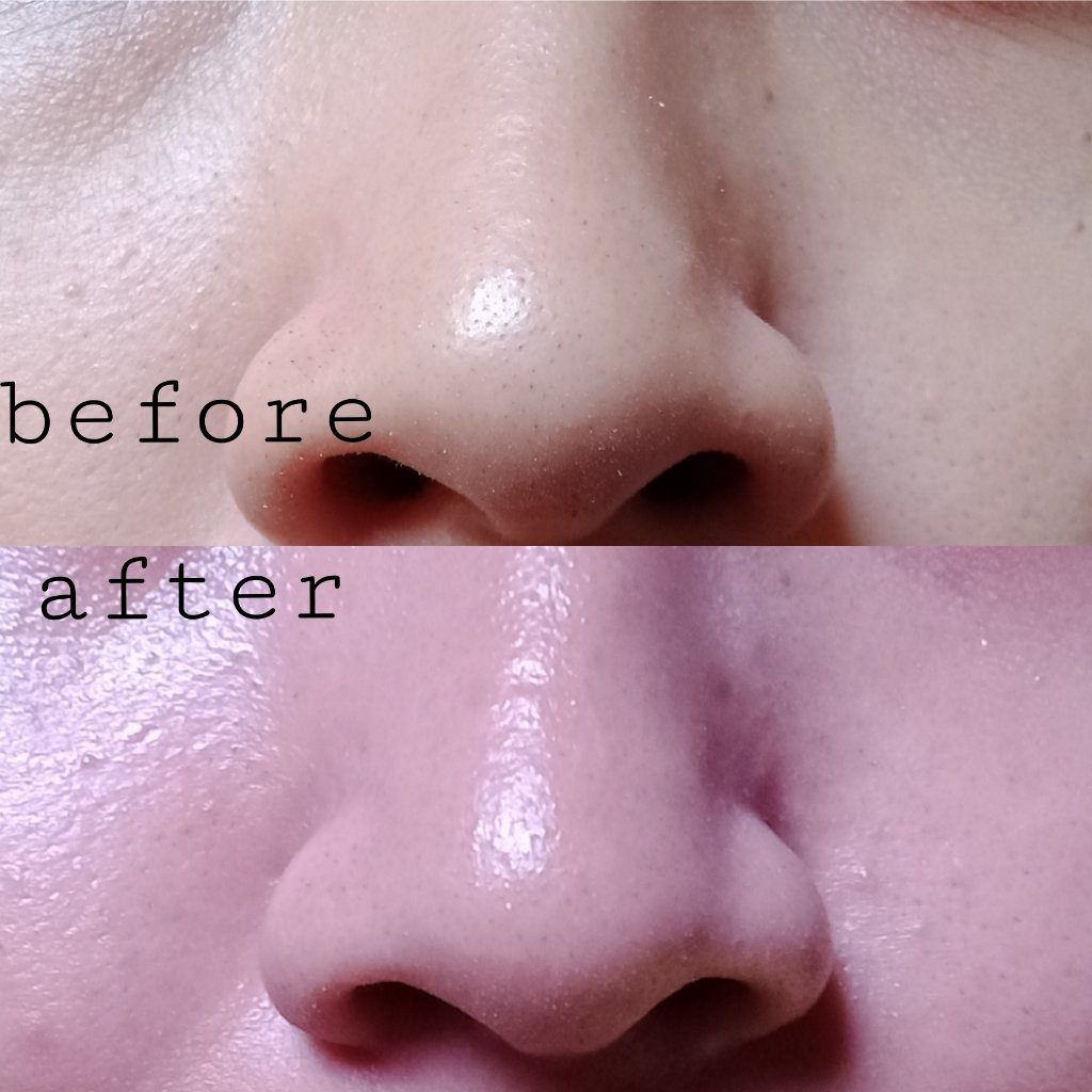 deeskaaa's tweet photo. Aku lagi suka banget pake peeling mask buat eksfoliasi udah beberapa minggu pake dan hasilnya kulitku berasa lebih bersih
#reviewdeska #racunskincare #perfectwhite https://t.co/lqQ08DIjgY
