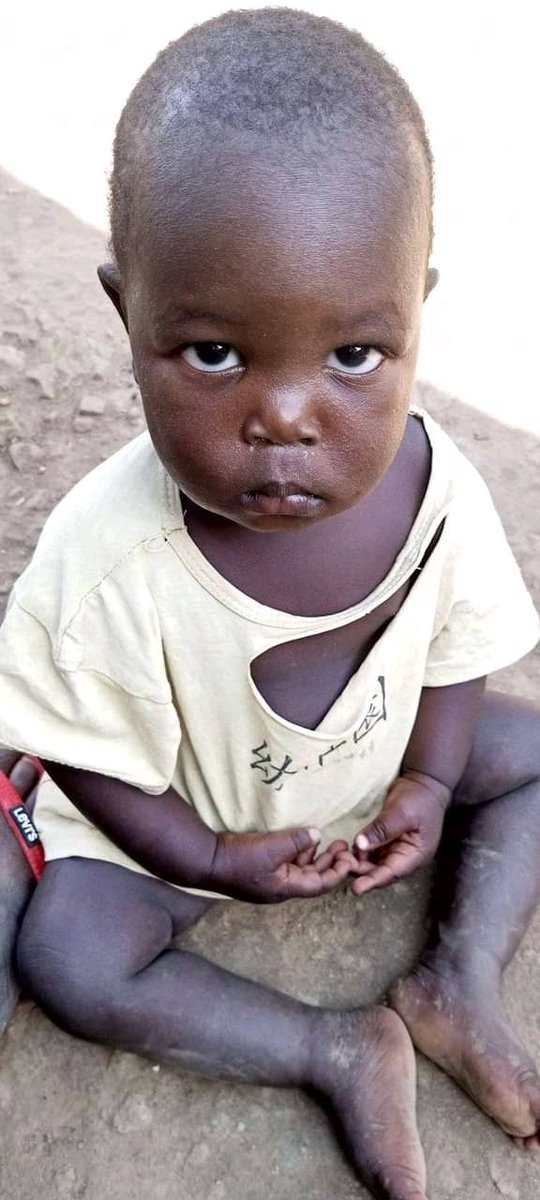 Milton is happy though the face shows agony. Thanks our friends for the support.