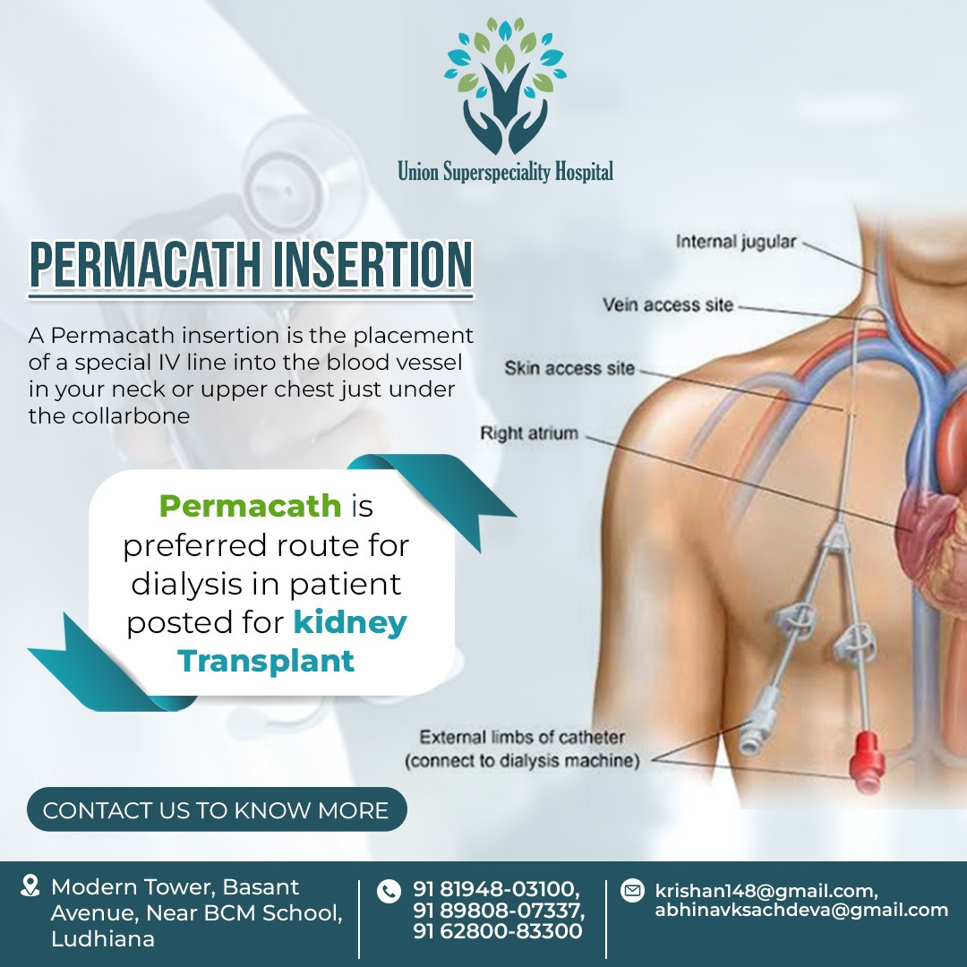 Unionhospitalss's tweet image. PERMACATH INSERTION
A Permacath insertion is the placement of a special IV line into the blood vessel in your neck or upper chest just under the collarbone 
#unionmultispecialtyhospital #healthcare #medicalprocedure #ivline #bloodvessel #neck #chest #rightatrium #skinaccesssite