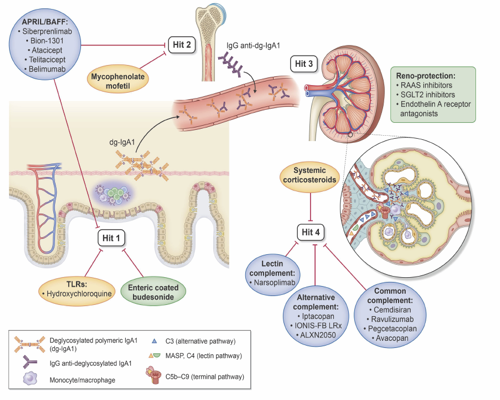 _JamesGleeson's tweet photo. Delighted to share our state-of-the-art review on treatment of IgAN https://t.co/BWryLAFXDA in @NDTsocial.                      Honoured to work on this with @IgAN_JBarratt and @MichelleOShaug3. Exciting times for IgAN therapeutics! https://t.co/oee6Rpnuuh