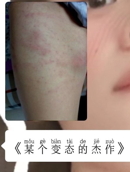 sfroea77's tweet photo. 看看屁股，看看屁股
@qingchuanccc https://t.co/LpbZsJCr1D