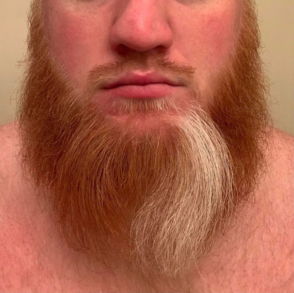 BeardDude tweet media