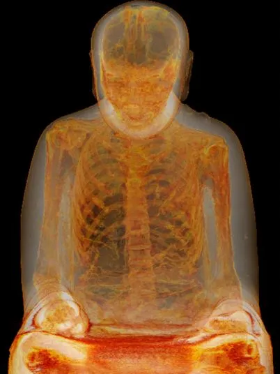 rarestorees's tweet photo. This ancient gold-plated statue.

It looked like a wonderful piece of art until it was taken for further examination. CT scan showed that it wasn’t just a piece of artwork , it was a human mummy.

In the past, some Japanese monks practiced what they called sokushinbutsu. They basically sat in a lotus position, ate slightly plant-based food until their bodies become weak and die. It was the mummification of oneself.

The amazing “artwork” was one of those devoted Buddhist whose followers turned into a demigod.
