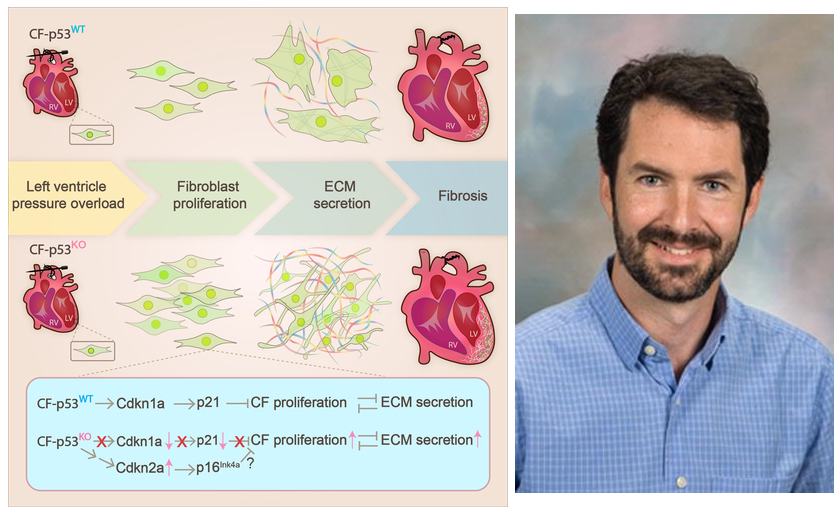 ExtracellMatrix's tweet image. Dr. Eric Small's team at @URochester_SMD uncover a mechanism regulating cardiac fibroblast accumulation and ECM secretion, orchestrated in part by p53-dependent #CellCycle control that governs the timing of fibrosis in left ventricular pressure overload.
bit.ly/3JMdWue