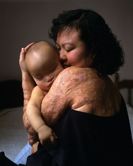 fotomundos's tweet photo. ¿Te suena esta foto? A lo mejor no la has visto nunca, pero estoy seguro, segurísimo, que sí has visto otra foto de la misma persona.

Te daré una pista: Guerra de Vietnam, napalm... 

¿A que ahora sí?

Te lo cuento en este 

👇 Hilo🪡🧵 👇 https://t.co/oI1pK67xLx