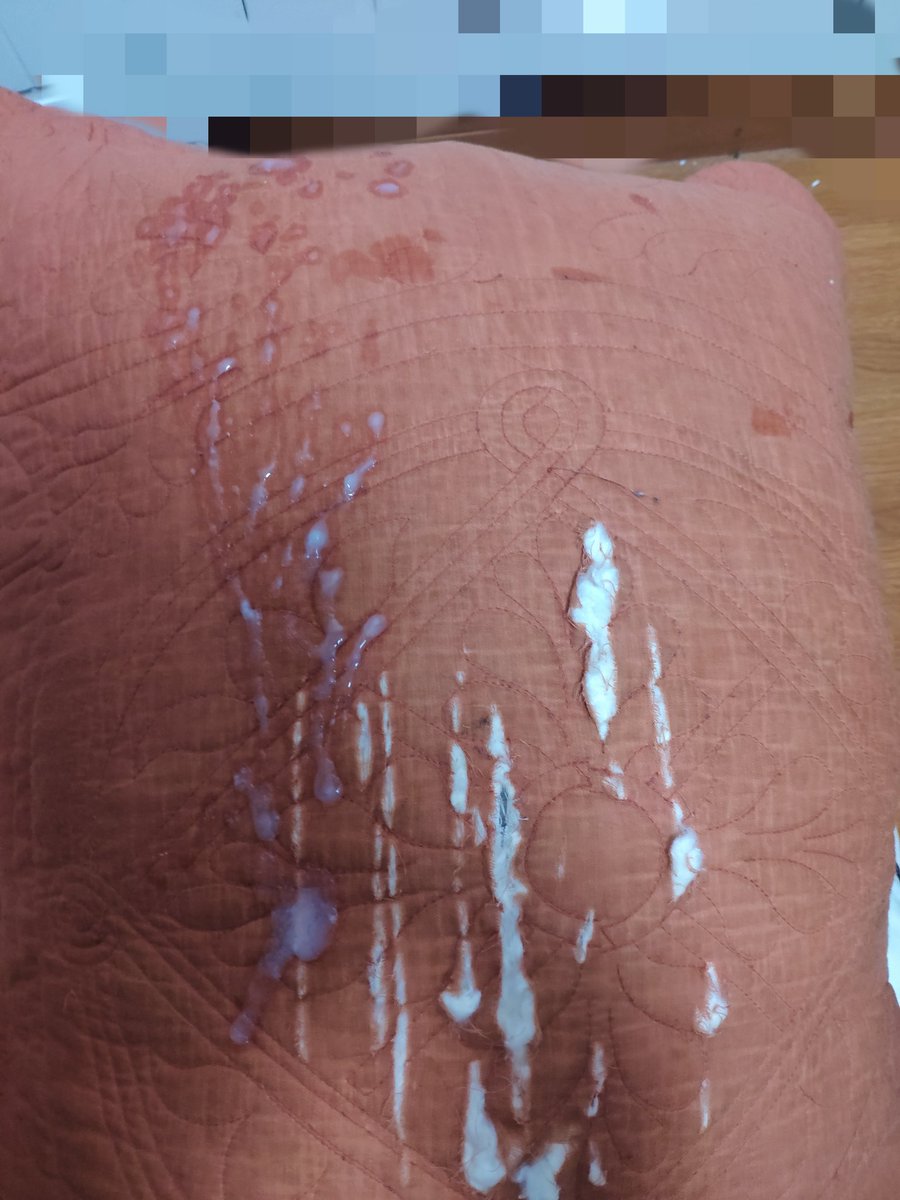 拆枕头的汪 tweet media