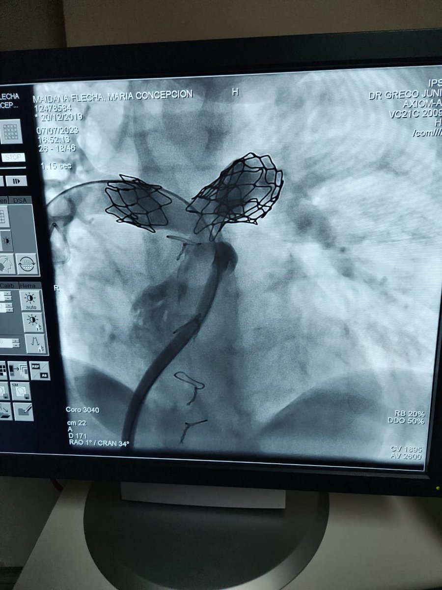 Felipe Nery Gervacio tweet media