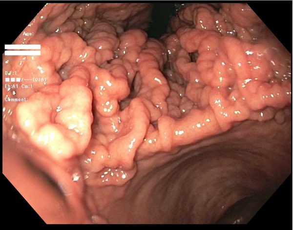 Keith Siau tweet media