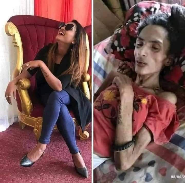 georgenjoroge_'s tweet photo. The first photo was taken and posted on Instagram on 14.09.2019 and the second photo taken on  08.06.2021 at Norvic Hospital . It is the same person, former Miss World Nepal second Runners-Up Nisha Ghimire.

Nisha was on top of her career in 2018 as a model and a top actress in Indian movies. She was just beginning to harvest the fruits of her dreams that she had pursued from childhood. Coming from a poor family, she had high hopes of lifting her family from poverty through her talent.

Companies competed to have her as their brand ambassador; big names in Nepal and India both in politics and entertainment  fought for her attention and everyone wanted to be associated with her.

Her star was rightly positioned to shine; Everyone saw a huge future in her.

In January 2019, she travelled to India to further her skill in Modelling and talent management at Derahdun. 

Unfortunately she got involved in a road accident. { according to local tabloids}  Months later, her family couldn't pay for her treatment, all the people who wanted to be with her at the peak of her fame disappeared.  

She was brought  back to her home in  Nepal to wait for her death. Friends would just visit to take photos like this second one and share on internet to earn likes but did absolutely nothing to help her. Politicians , entertainers and all those who followed her were not there.

At the height of her career, among the people who wanted her service to push their brand was an entrepreneur called Megha Chaudhary. Her manager refused that she shouldn't work with Megha because her business was "small" Megha learnt of her sickness through internet and specifically her photos posted by friends that went viral.

It is only this Megha that came to her rescue the last minute when no one couldn't come through. Even her own manager ran and couldn't be traced. Megha paid her hospital bills at Norvic, and the cost for therapies. 

Sadly she didn't make it. Nisha passed away on 01.09.2021. It is Megha who took care of the burial expenses and offered to pay fees for her siblings including the one at university. 

Those who cheer you up when you are winning will most probably not be on your side when you are losing.