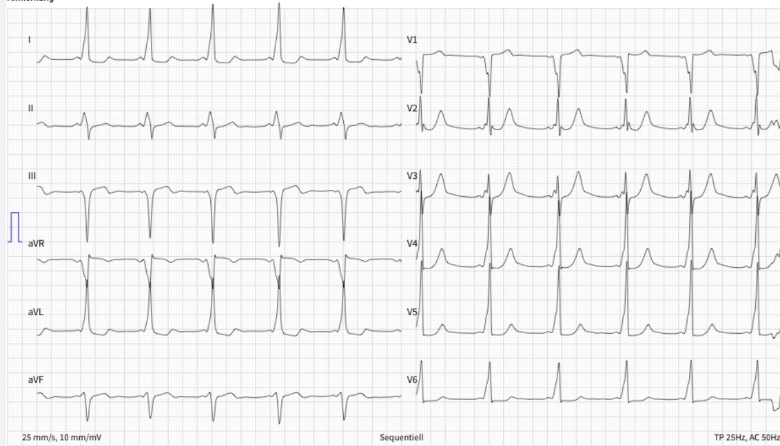 DrV_Mann's tweet photo. WPWs of this week!
@AGEP_DGK @YoungDgk @DGK_org @bordistef @syamkumarmd @ALFIEEP1 @melhamriti https://t.co/LwU17AqQwk