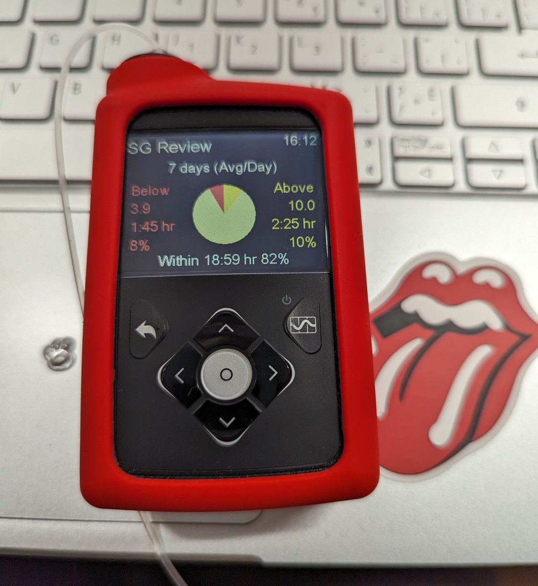 FatCatAnna's tweet photo. Even tho' I am on an older @MedtronicCA #insulin pump after trial of closed looping #780G -I'm telling you-as an #OCD #T1D -I am really happy with my #TIR -plus finally bought a nifty case to keep this no longer in warranty piece of #technology safe & sound! #level57 #diabetes https://t.co/F4KM58GzDl