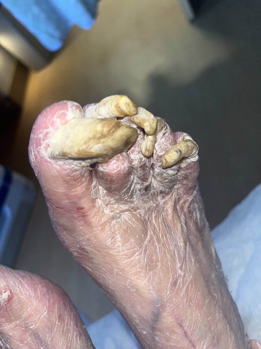 bhakes24's tweet photo. For the love of god pls take care of your elderly family members

-your friendly neighborhood podiatrist https://t.co/VRFyzNxHOp
