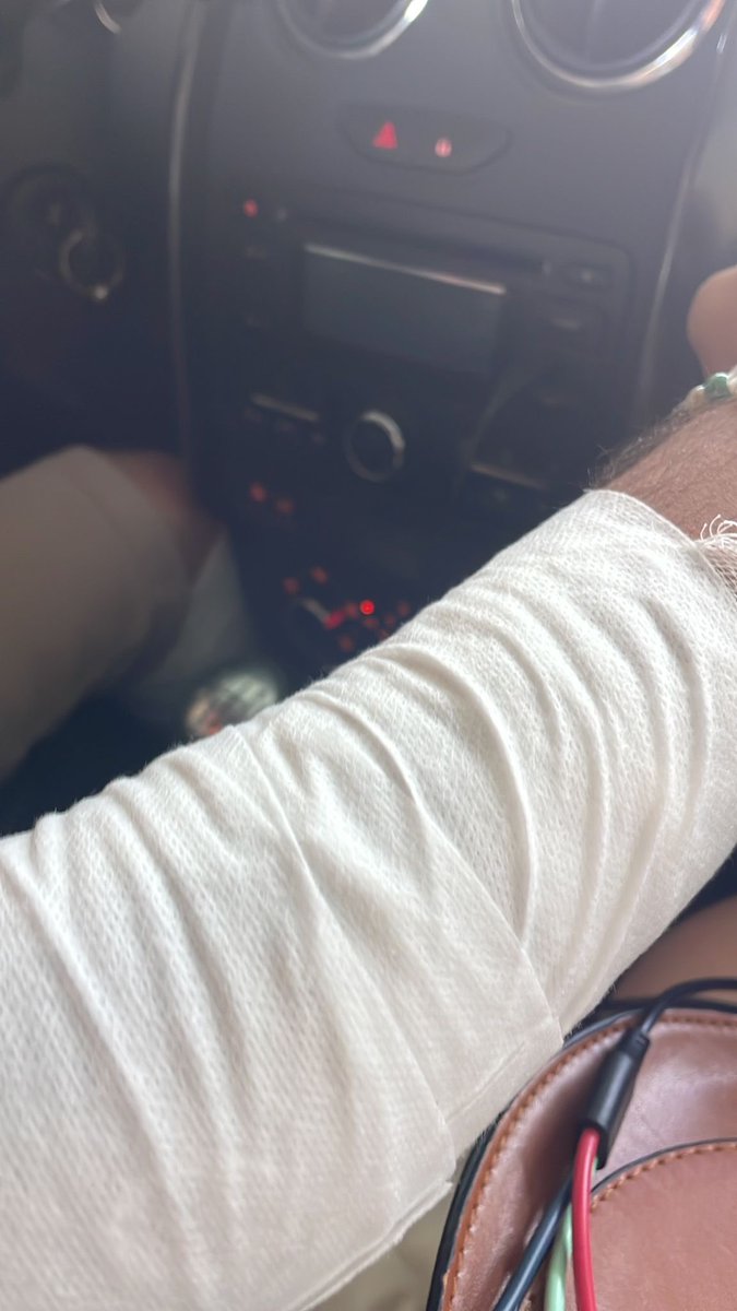 KosedagNevin's tweet photo. @drfahrettinkoca Bakanım Unkapanı Medipol Diş hastanesi iki aydır bahçe düzenlemesi olup hastene içine girebilmek için iki uyduruk tahtadan merdiven yapılmış cuma günü bu uyduruk merdivenden düştüm alta resimlerim lakin tedavi olurken uyduruk merdiven kaldırılmış bilginize https://t.co/RDRB6bArbm