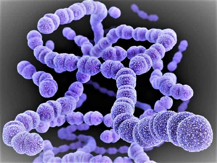 elbonanews's tweet photo. 🔴#Alerta por los casos de #infección invasiva por #Streptococcus #pyogenes en el país
🔴Se registraron 118 #personas alcanzadas por la #enfermedad con un saldo de 16 #fallecidos.
Leé la nota acá👇
https://t.co/wzNTDmrRCY https://t.co/blUD7ZCqLt