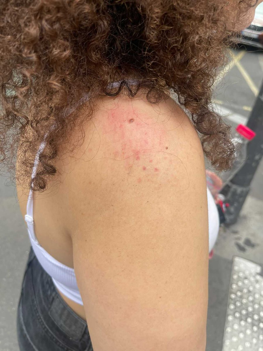 laveritepradama's tweet photo. La femme qui a subit des violences par la BRAV-M est sous le choc. Elle ne représentait aucune menace, des violences inadmissibles. Nous l'accompagnons dans les démarches pour défendre ses droits. JUSTICE! https://t.co/omBRVkYHzq