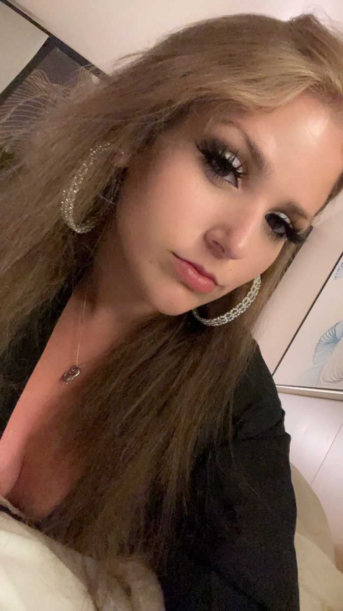 i am so sunburnt🤧