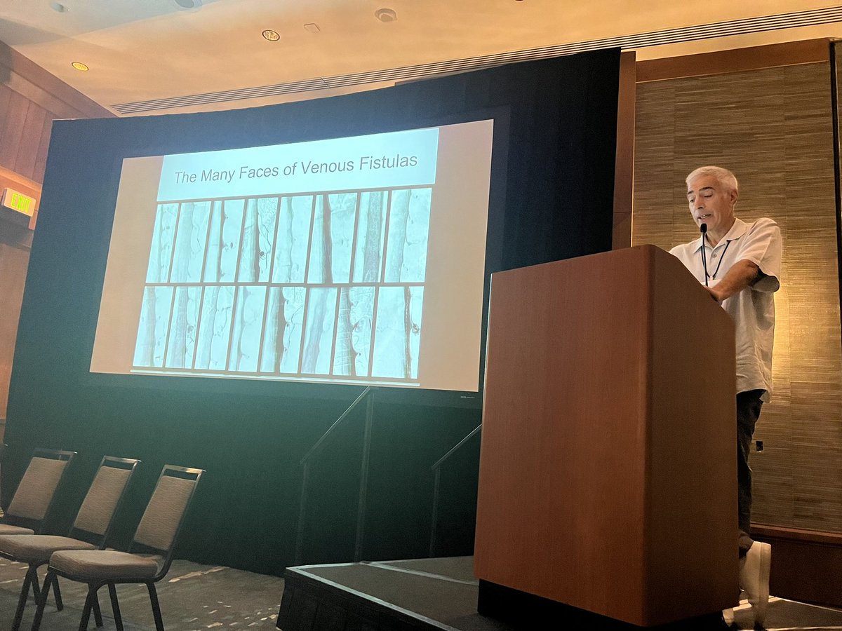 NeuroradLal's tweet image. Fantastic morning session from the pioneers of spinal CSF leak care @WouterSchievink @marcelmaya @PeterGKranz @JrgenBeck @CedarsSinai #SIH symposium #spinalcsfleak awesome talks and discussion 🤩🤩👏🏾👏🏾👏🏾