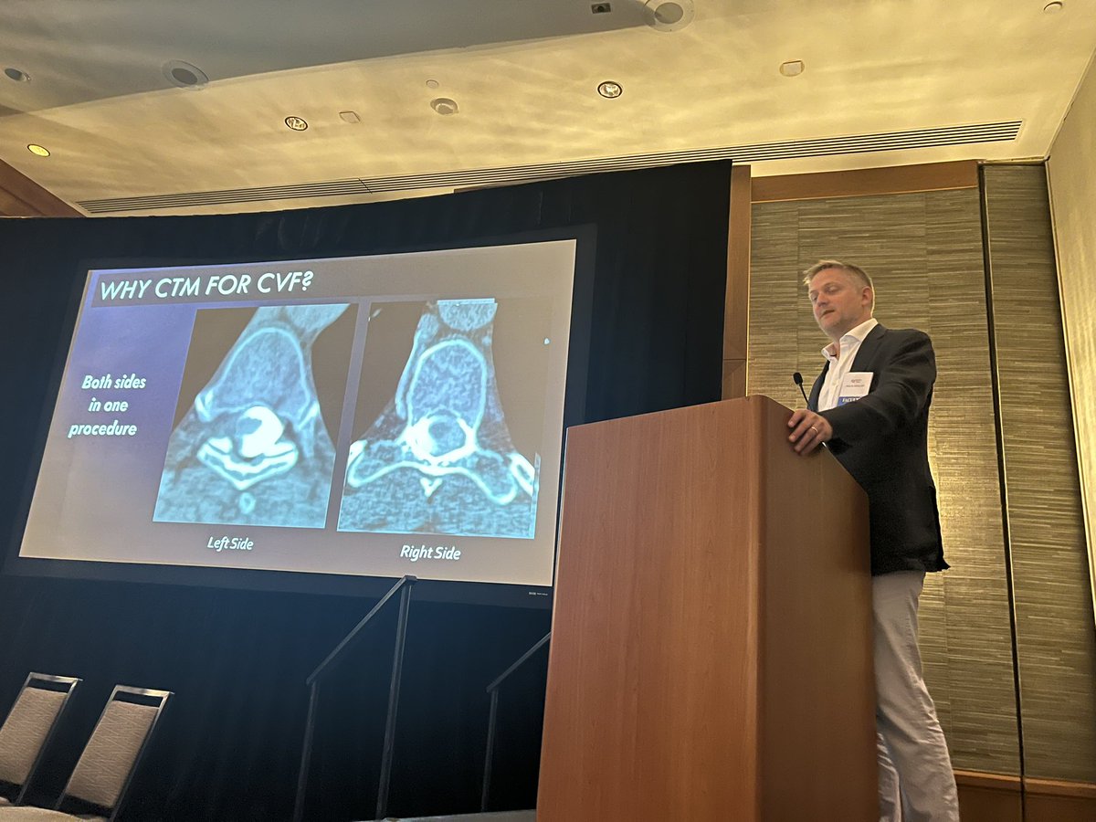 NeuroradLal's tweet image. Fantastic morning session from the pioneers of spinal CSF leak care @WouterSchievink @marcelmaya @PeterGKranz @JrgenBeck @CedarsSinai #SIH symposium #spinalcsfleak awesome talks and discussion 🤩🤩👏🏾👏🏾👏🏾