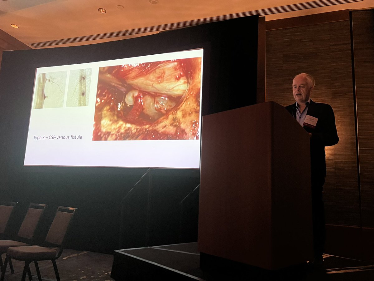 NeuroradLal's tweet image. Fantastic morning session from the pioneers of spinal CSF leak care @WouterSchievink @marcelmaya @PeterGKranz @JrgenBeck @CedarsSinai #SIH symposium #spinalcsfleak awesome talks and discussion 🤩🤩👏🏾👏🏾👏🏾
