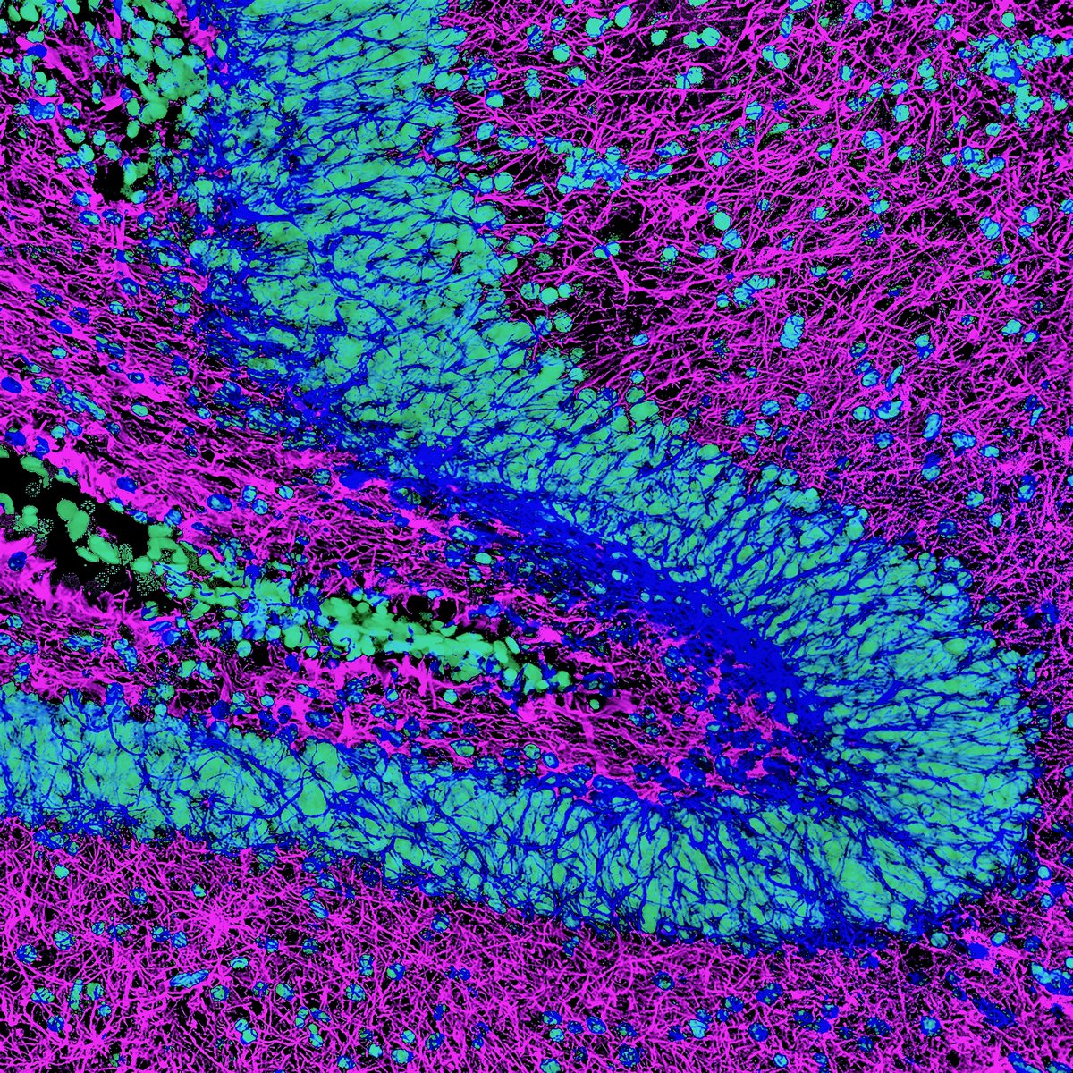 A colorful hippocampus with a big blood vessel! 🔬🤓 #NeuroTwitter #neuroscience