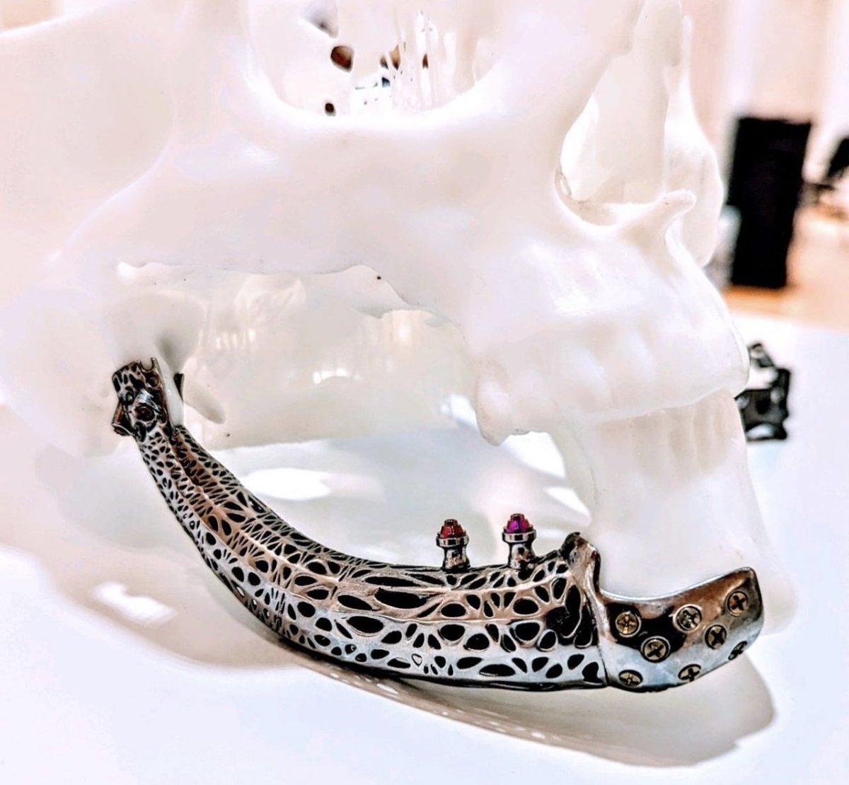 K_AF_A's tweet photo. No Bone ? No Problem! من المعالجات المتقدمة ورفع مستوى وكفائة الجراحين في التخصصات الدقيقة في طب الأسنان .. #BoneEasy https://t.co/o0j6ruJ55e