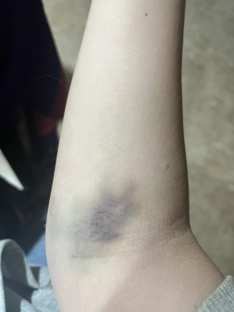 SaritaaaaRod's tweet photo. Se me va a caer el brazo 🥲 https://t.co/6ZaxGUiovn