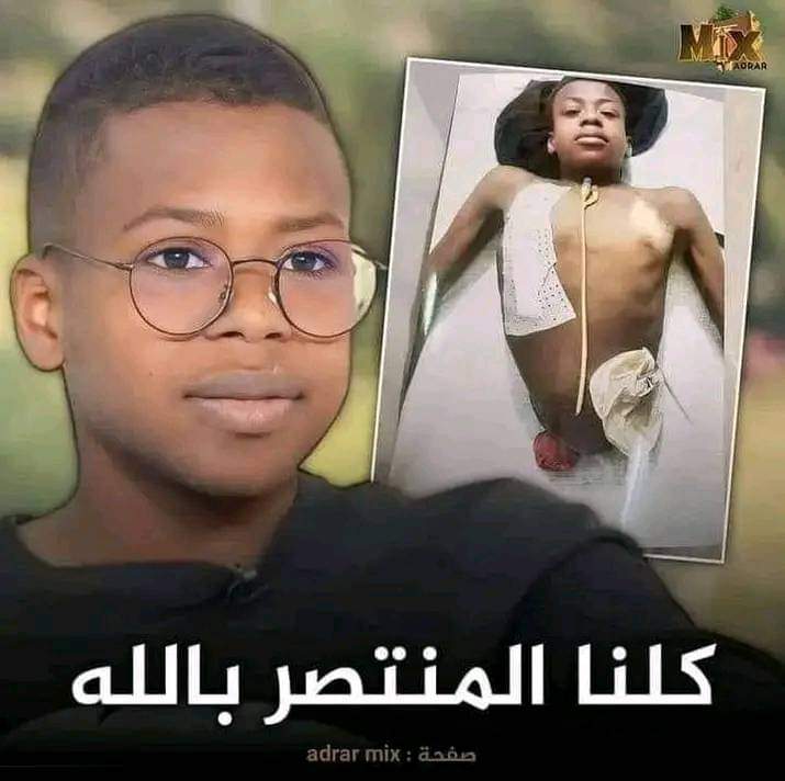 سيدي الرئيس طلبنا بسيط جدا وهو التكفل بابن ولاية تقرت ودائرة تماسين منتصر بالله حفيان ان شاءالله تلحق الرسالة نتاعنا ربي يشفيك ان شاءالله خويا منتصر بالله 😢😢